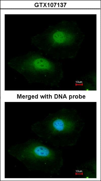 IHC-plus™ BPGM Antibody (aa1-246)