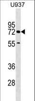 Polyclonal Rabbit anti-Human CERCAM Antibody (aa492-519, WB)