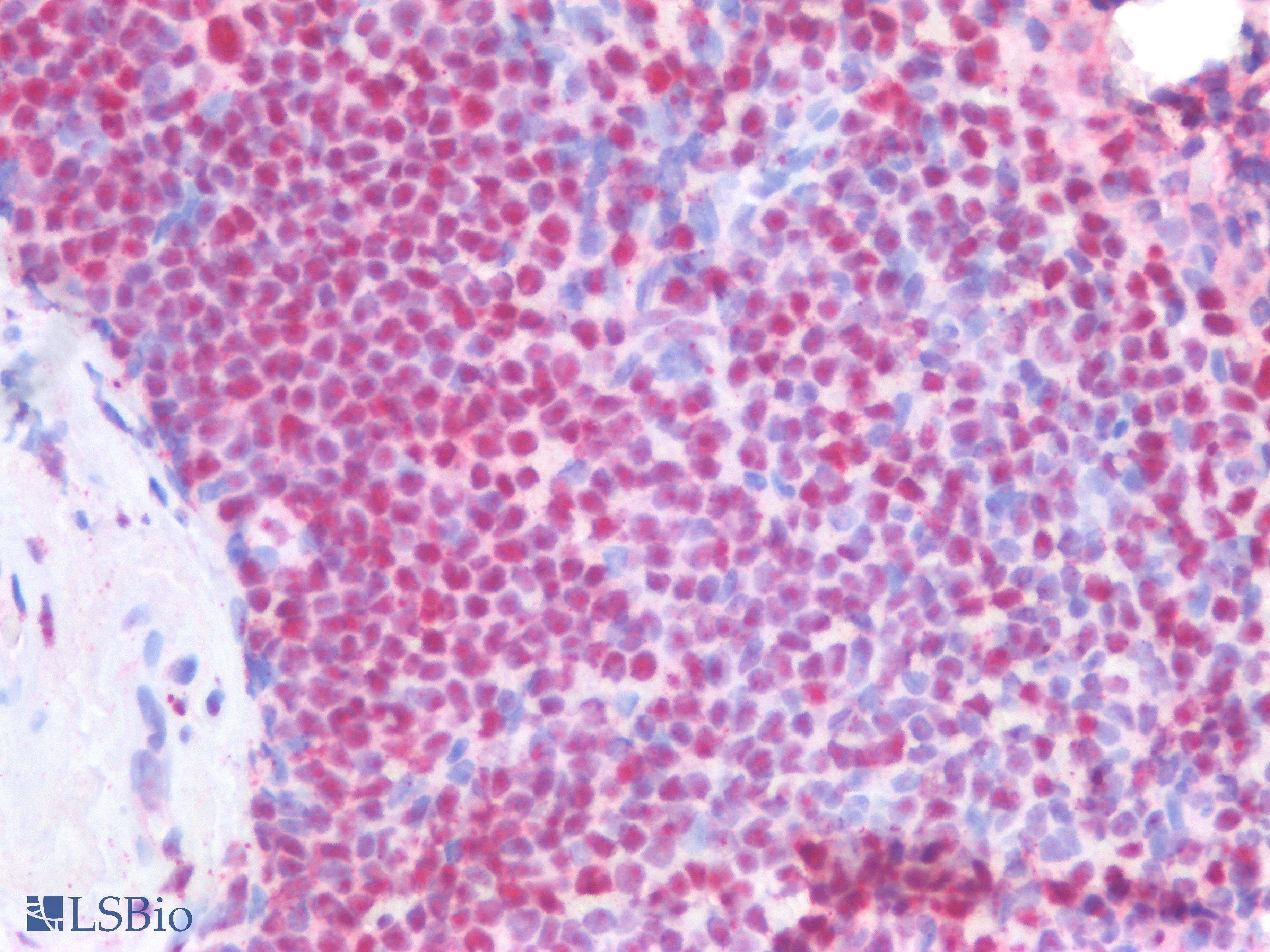 IHC-plus™ Polyclonal Goat anti-Human NPM1 / NPM / Nucleophosmin Antibody (aa281-294, IHC, WB)