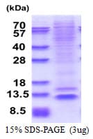 Human NUP62CL Protein (Recombinant His)
