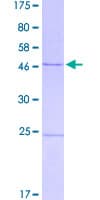 Human CSA / ERCC8 Protein (Recombinant GST)