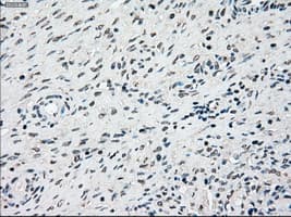 Monoclonal Mouse anti-Human SSB / La Antibody (clone OTI3F11, IHC, IF, WB)