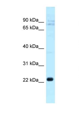 CLEC5A / MDL-1 Antibody (aa110-159)