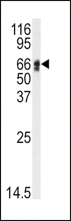 AGT / Angiotensinogen Antibody (aa37-65)