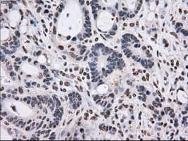 Monoclonal Mouse anti-Human PSMD10 / Gankyrin Antibody (clone OTI3F6, WB)