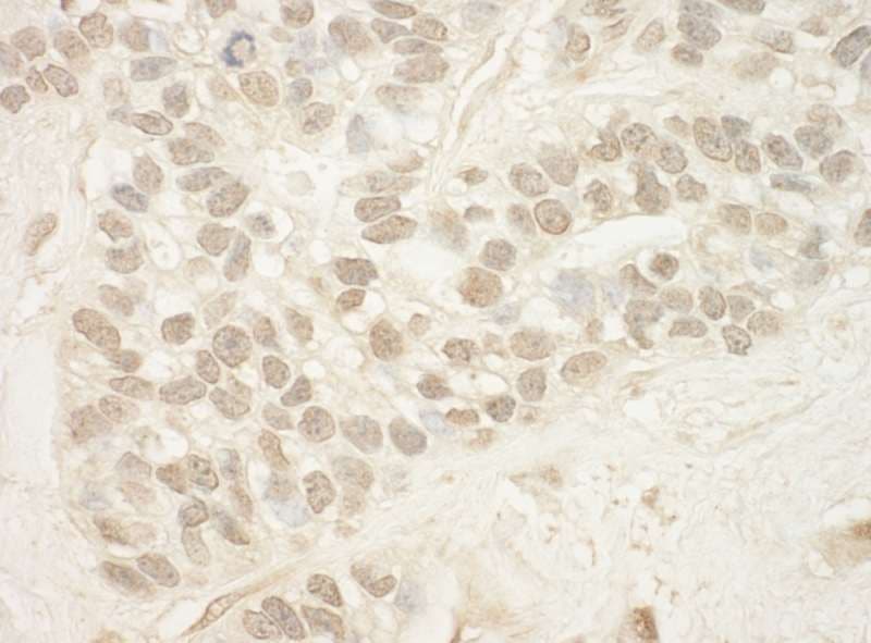 MED15 / ARC105 Antibody (aa450-500)