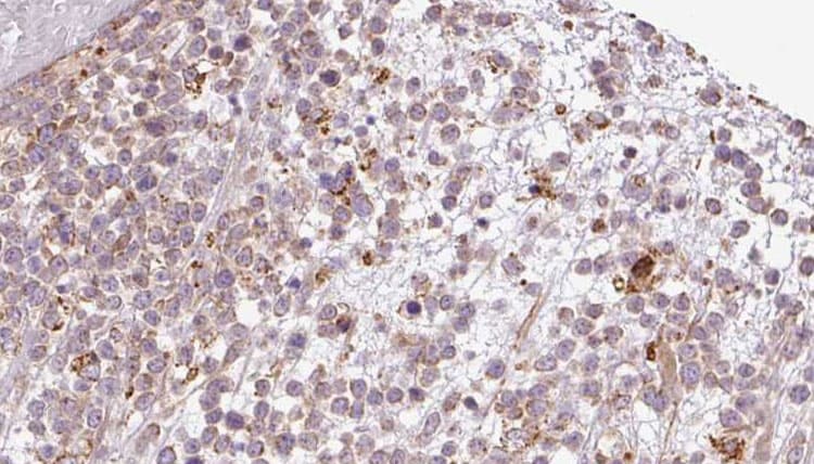 BAMBI Antibody