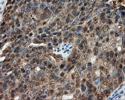 CELF1 / CUGBP1 Antibody (clone OTI5B8)