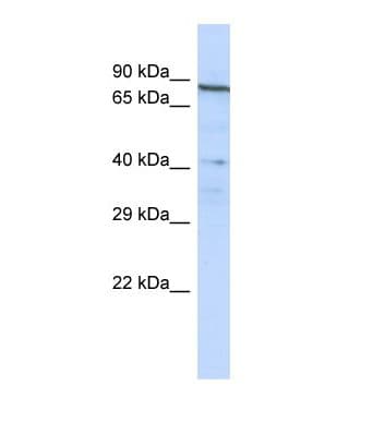 Polyclonal Rabbit anti-Human NOBOX Antibody (aa113-162, WB)