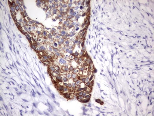 Acidic Cytokeratin Antibody (clone 5F9)