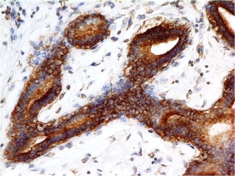 ERBB2 / HER2 Antibody