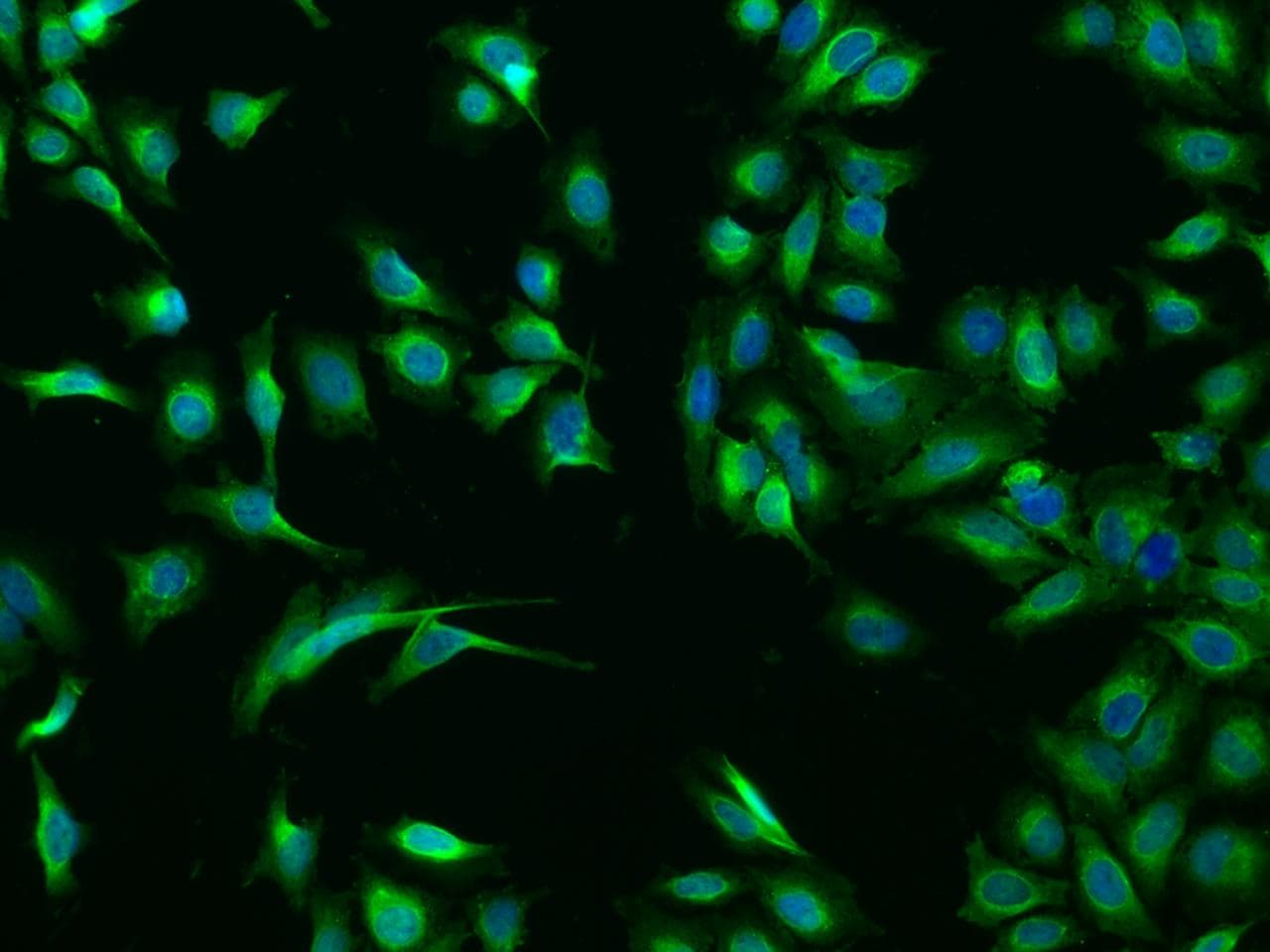 Polyclonal Rabbit anti-Human CASQ1 / Calsequestrin 1 Antibody (Preservative Free, IHC, IF)