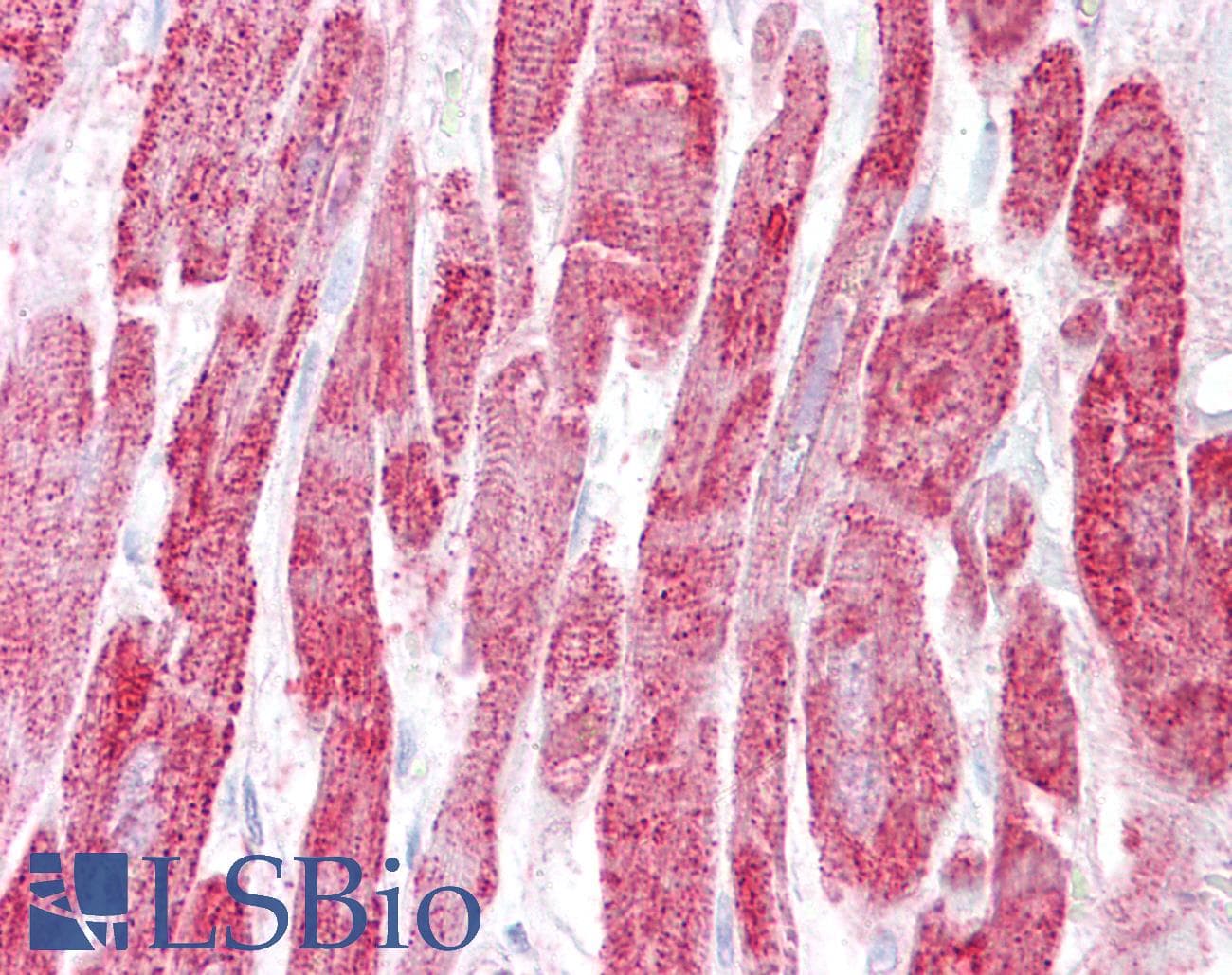 IHC-plus™ EPM2A / Laforin Antibody (aa131-144)