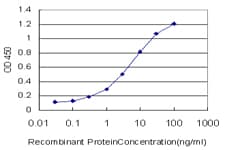 Monoclonal Mouse anti-Human SWAP70 Antibody (clone 3H8, IHC, WB)
