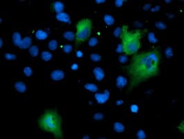 ASNS Antibody (clone OTI1A10)
