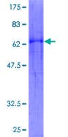 Human WNT5B Protein (Recombinant GST)