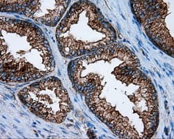 PIM2 / Pim-2 Antibody (clone OTI8G10)