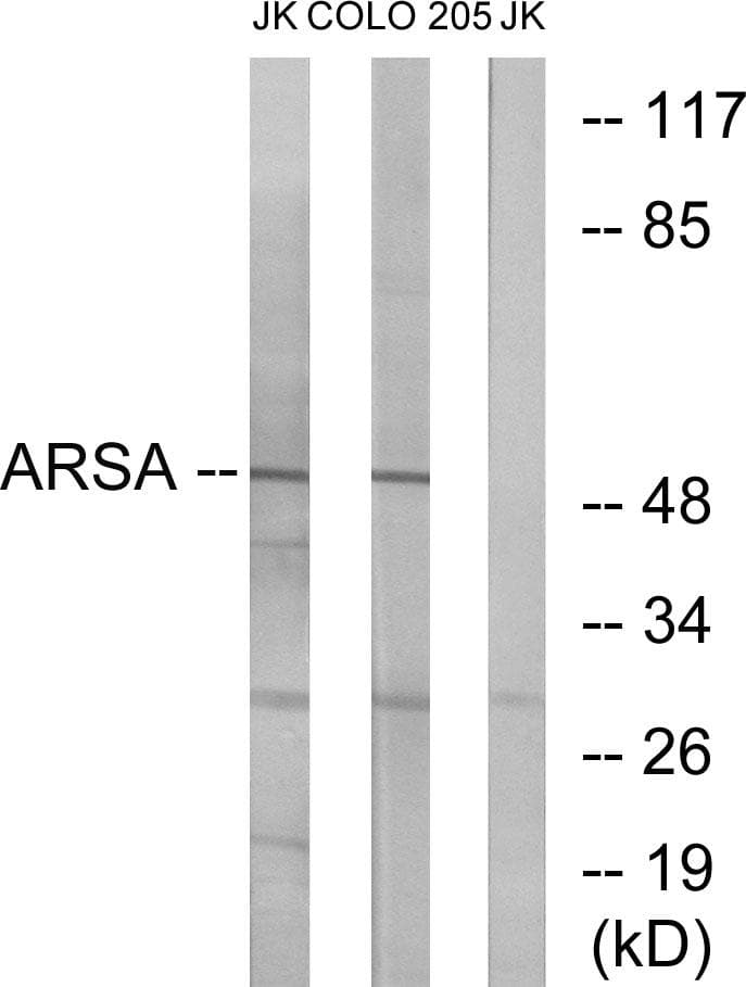 Polyclonal Rabbit anti-Human ARSA / Arylsulfatase A Antibody (IHC, WB)