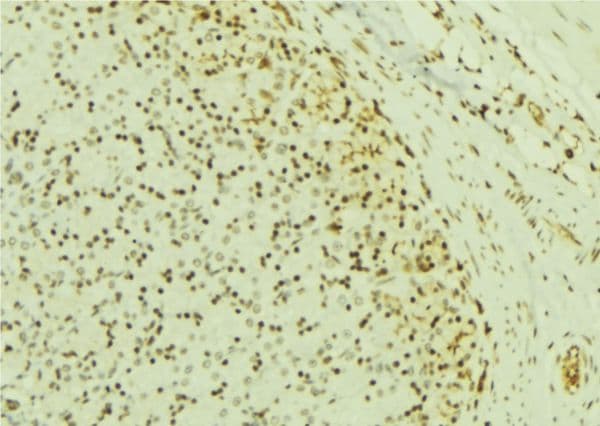 RPS6KB1 / P70S6K / S6K Antibody