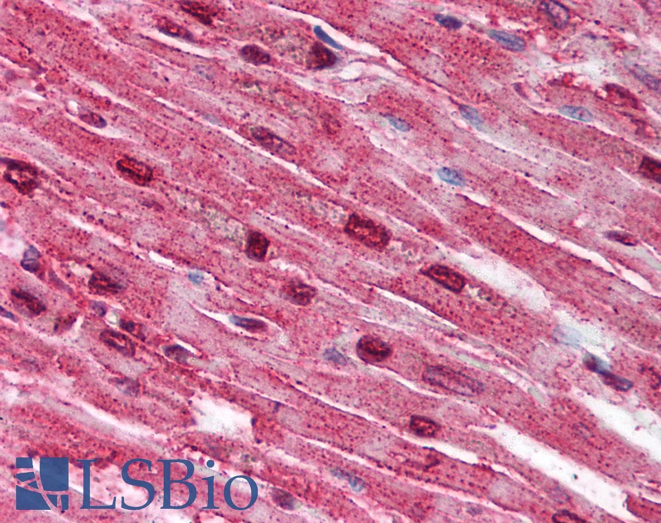 IHC-plus™ SPTLC2 / LCB2 Antibody (aa548-562)