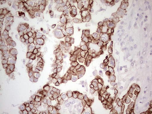 ABCB1 / MDR1 / P Glycoprotein Antibody (aa995-1280, clone OTI10H3, Carrier-free)