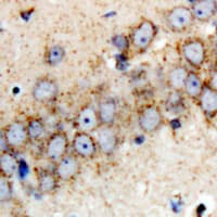 PARK2 / Parkin 2 Antibody (Internal)