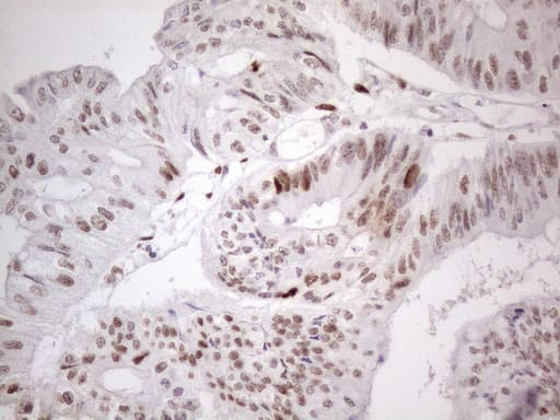 TP53BP1 / 53BP1 Antibody (aa1-300, clone OTI5E1)