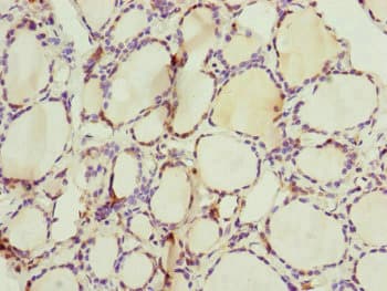 Polyclonal Rabbit anti-Human CEP44 / KIAA1712 Antibody (IHC, WB)
