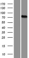 ALKBH8 Protein (Over-Expression Lysate Myc-DDK (Flag))