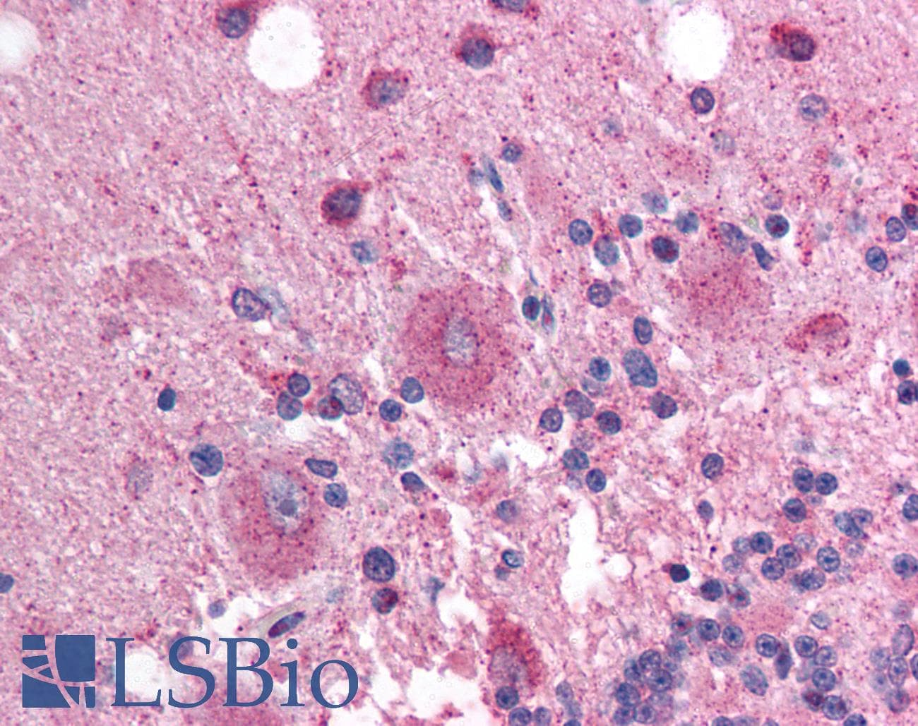 Polyclonal Rabbit anti-Human SOX3 Antibody (aa80-129, IHC, WB)