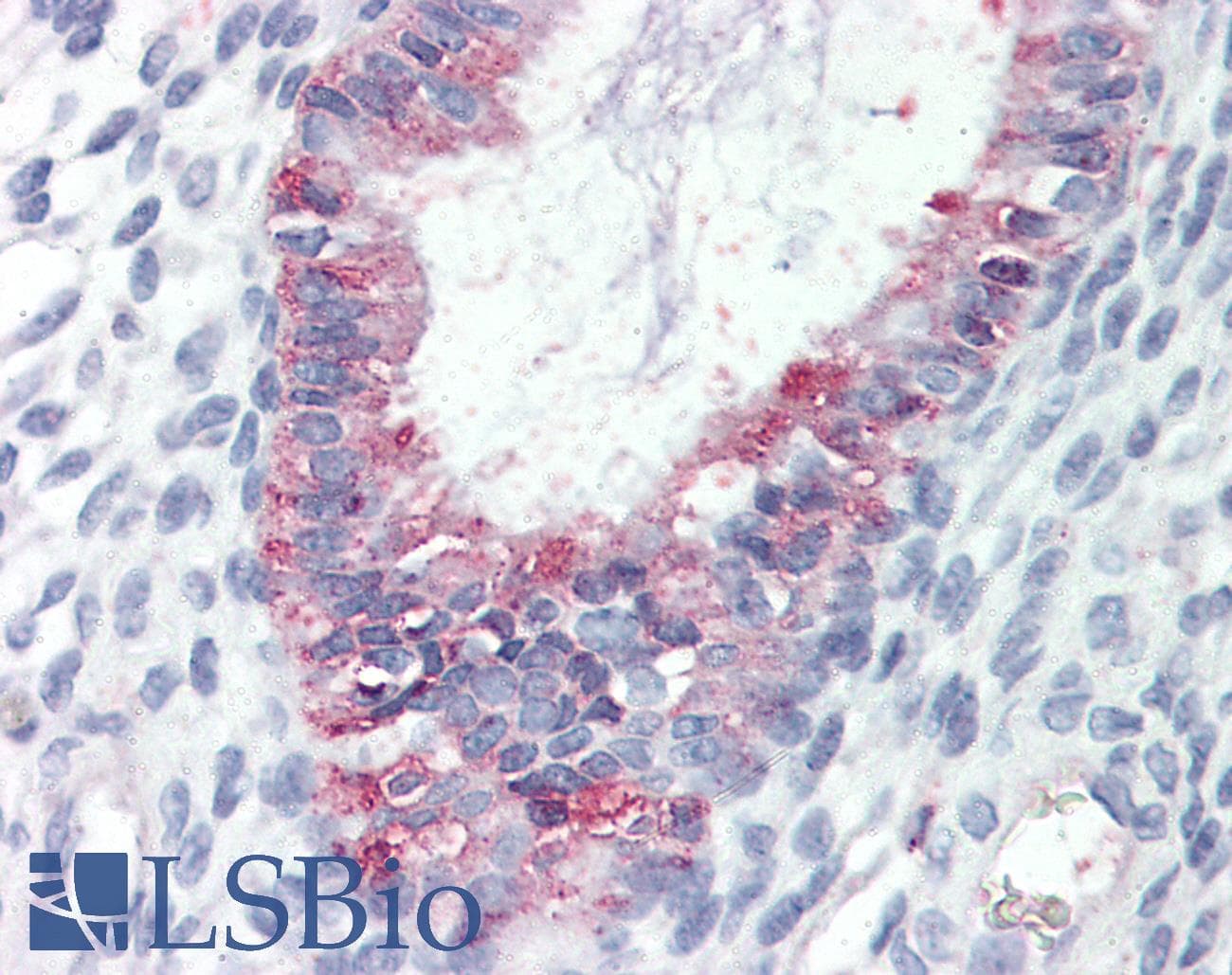 IHC-plus™ Polyclonal Rabbit anti-Human GPR27 Antibody (Internal, IHC)