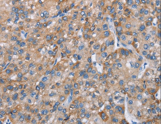 CHDH / CHD Antibody