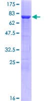 Human TPH1 / Tryptophan Hydroxylase Protein (Recombinant GST)