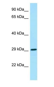Polyclonal Rabbit anti-Human CSF2RA / CD116 Antibody (aa88-137, WB)