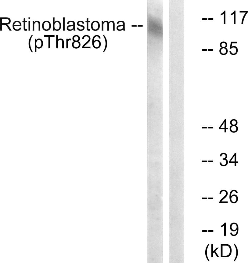 RB1 / Retinoblastoma / RB Antibody (phospho-Thr826)