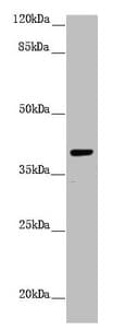 Polyclonal Rabbit anti-Human H2AFY / MACROH2A1 Antibody (IHC, WB)