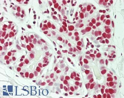IHC-plus™ SF3B130 / SF3B3 Antibody (aa1167-1217)