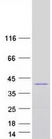 Human LBX1 Protein (Recombinant Myc-DDK (Flag))