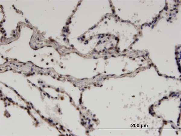 ZNF192 Antibody (clone 3B10)