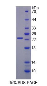Human UACA Protein (Recombinant His-S)