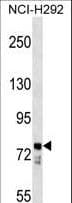 Polyclonal Rabbit anti-Human BBS7 Antibody (aa73-99, WB)