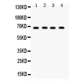 GRK5 Antibody (aa393-429)