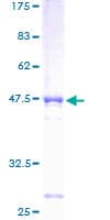Human CENPU / MLF1IP Protein (Recombinant GST)