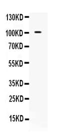 NARG1 / NAA15 Antibody