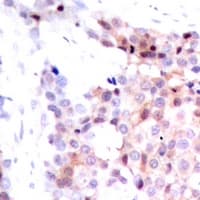 Polyclonal Rabbit anti-Human SMAD3 Antibody (IHC, WB)