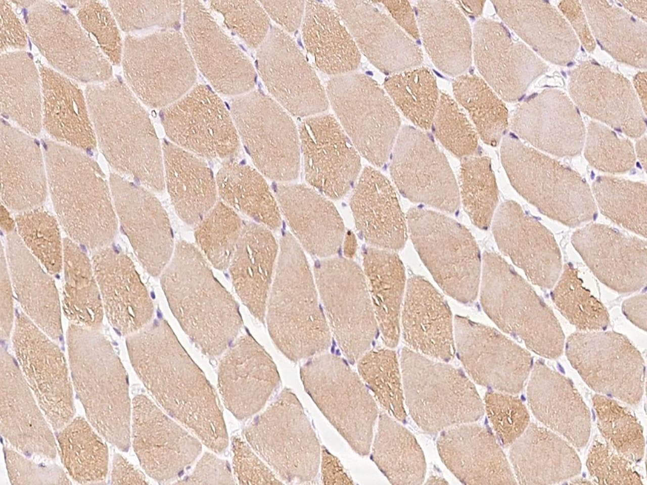 LMOD2 Antibody
