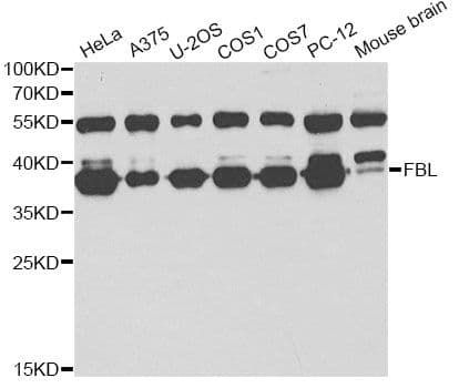 FBL / FIB / Fibrillarin Antibody