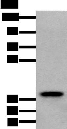 ZPBP / SP38 Antibody