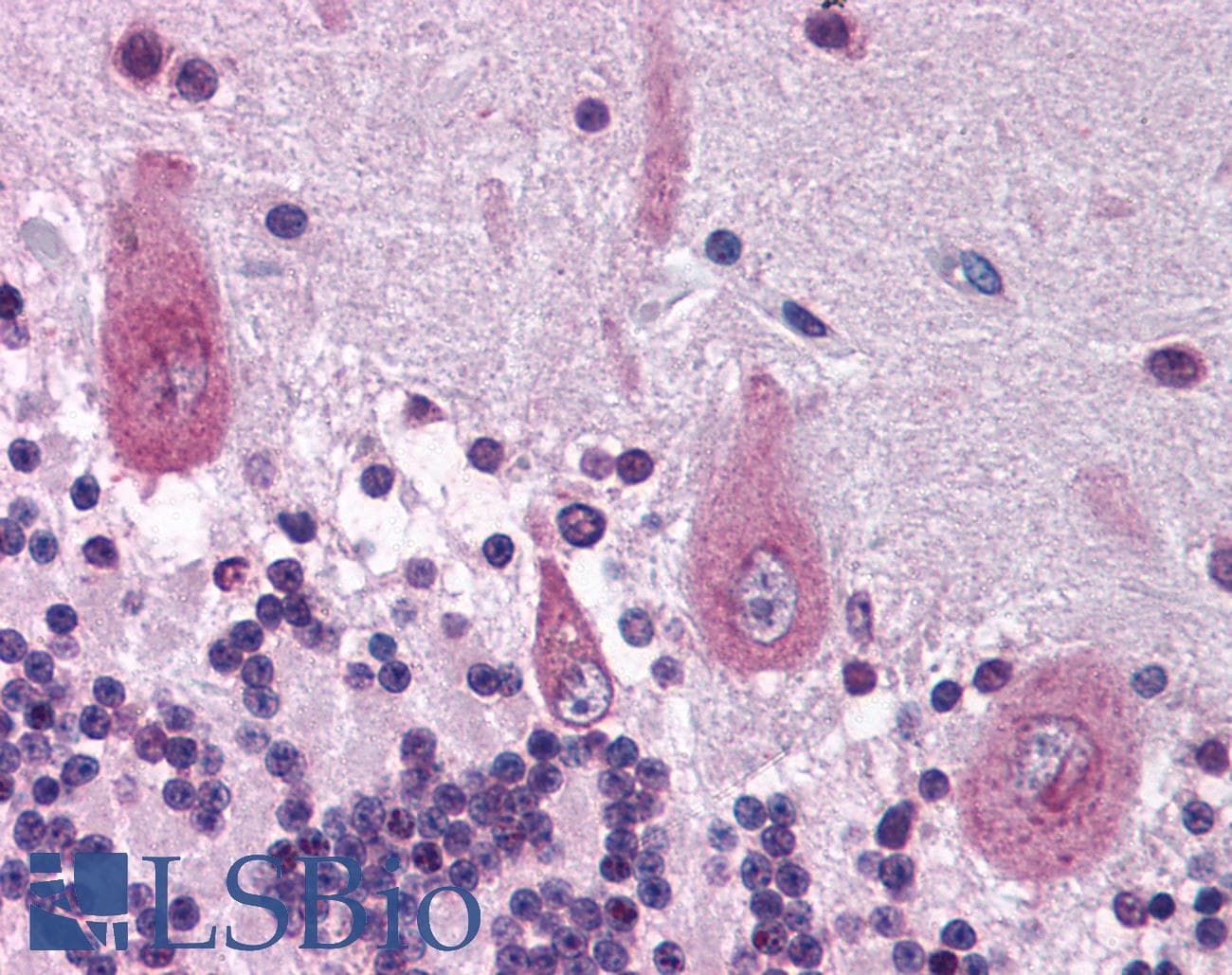 Polyclonal Rabbit anti-Human KIF21A Antibody (aa551-600, IHC, WB)