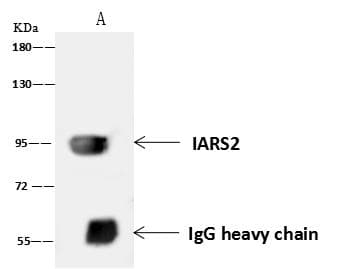 Polyclonal Rabbit anti-Human DDX21 Antibody (IF, WB)